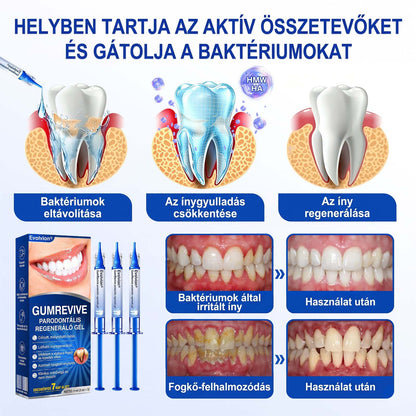 Evolvion® 🦷 GumRevive Ínyregeneráló Gél – Az egészségesebb ínyért és magabiztosabb mosolyért 👍