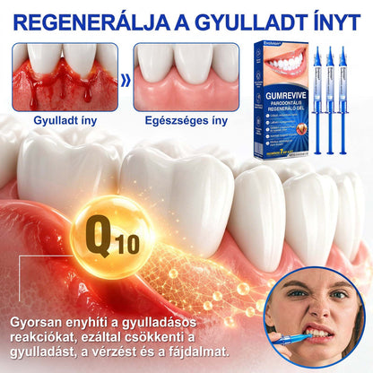Evolvion® 🦷 GumRevive Ínyregeneráló Gél – Az egészségesebb ínyért és magabiztosabb mosolyért 👍