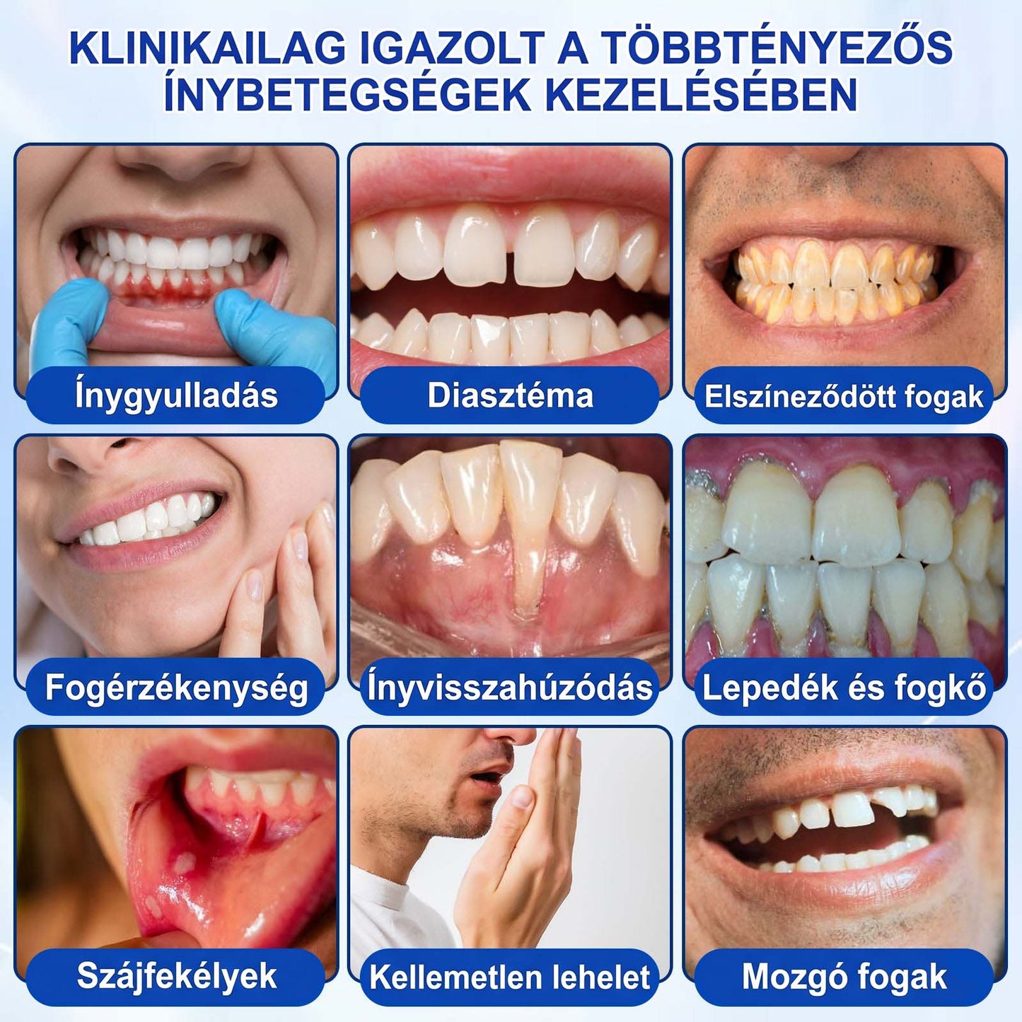 Evolvion® 🦷 GumRevive Ínyregeneráló Gél – Az egészségesebb ínyért és magabiztosabb mosolyért 👍