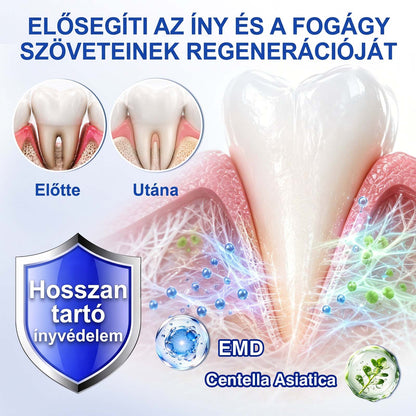 Evolvion® 🦷 GumRevive Ínyregeneráló Gél – Az egészségesebb ínyért és magabiztosabb mosolyért 👍