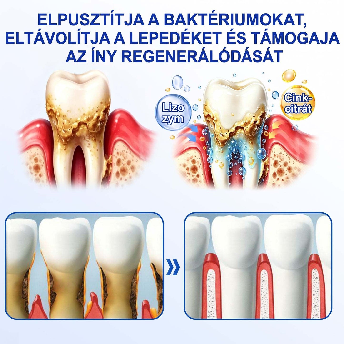Evolvion® 🦷 GumRevive Ínyregeneráló Gél – Az egészségesebb ínyért és magabiztosabb mosolyért 👍