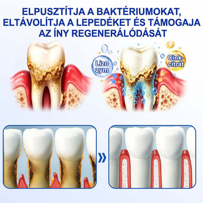 Evolvion® 🦷 GumRevive Ínyregeneráló Gél – Az egészségesebb ínyért és magabiztosabb mosolyért 👍