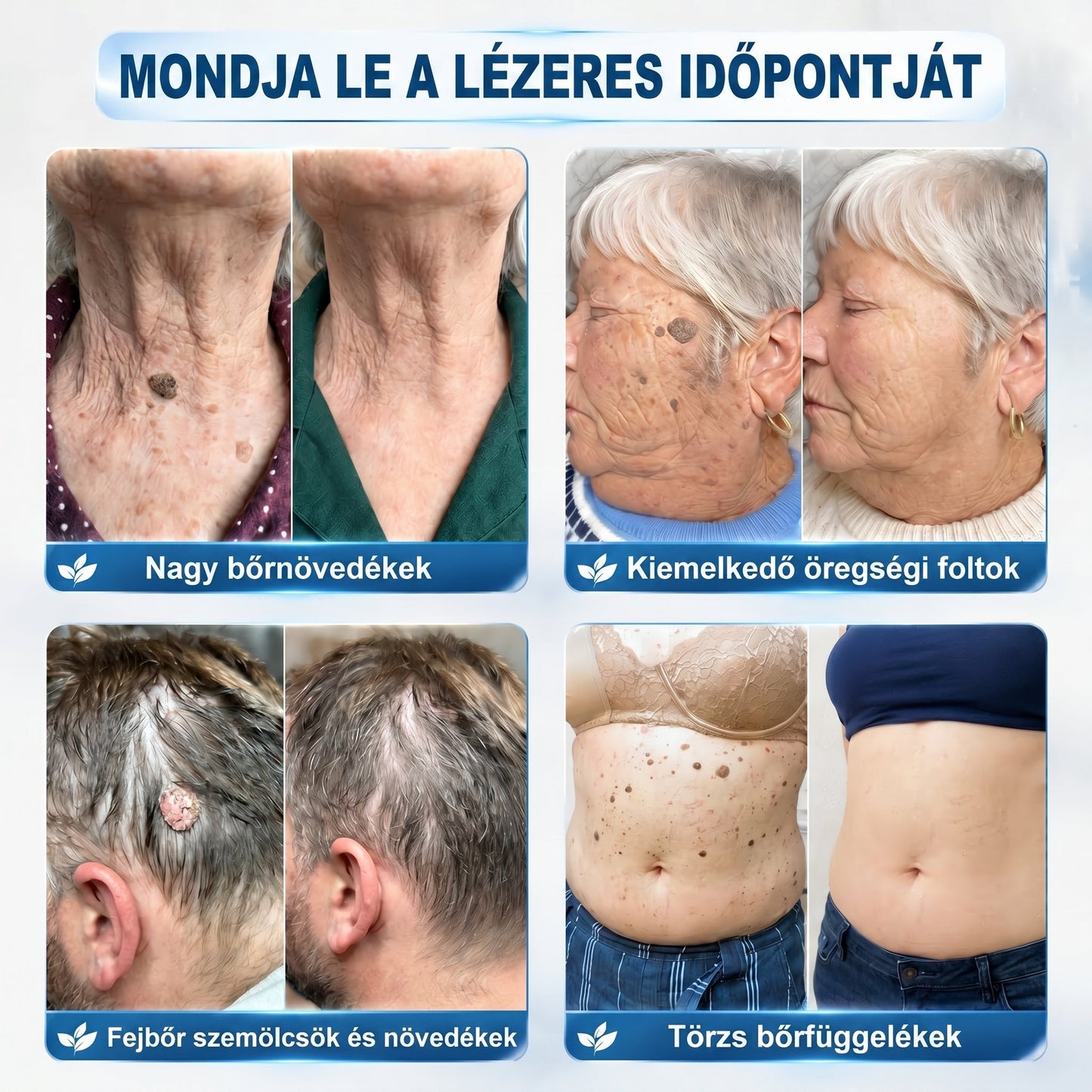 𝐇𝐢𝐯𝐚𝐭𝒂𝒍𝒐𝒔 𝒎á𝗿𝗸𝗮𝗯𝗼𝗹𝐭 | 🖊️ 𝐏i𝐜𝐝𝐨® 𝟕 𝐧𝐚𝒑𝒐𝒔 𝒔𝒛𝗲𝗺ö𝗹𝗰𝘀- é𝐬 𝐟𝐨𝐥𝐭𝐞𝐥í𝐭ó (𝐟á𝐣𝐝𝐚𝐥𝒐𝒎𝒎𝒆𝒏𝒕𝒆𝒔, 𝒉𝒆𝗴 𝗻é𝗹𝗸ü𝐥𝐢 𝐠𝐨𝐥𝐲ó𝐬 𝐚𝐩𝐩𝐥𝐢𝐤á𝐭𝐨𝐫)🎄