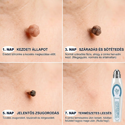 𝐇𝐢𝐯𝐚𝐭𝒂𝒍𝒐𝒔 𝒎á𝗿𝗸𝗮𝗯𝗼𝗹𝐭 | 🖊️ 𝐏i𝐜𝐝𝐨® 𝟕 𝐧𝐚𝒑𝒐𝒔 𝒔𝒛𝗲𝗺ö𝗹𝗰𝘀- é𝐬 𝐟𝐨𝐥𝐭𝐞𝐥í𝐭ó (𝐟á𝐣𝐝𝐚𝐥𝒐𝒎𝒎𝒆𝒏𝒕𝒆𝒔, 𝒉𝒆𝗴 𝗻é𝗹𝗸ü𝐥𝐢 𝐠𝐨𝐥𝐲ó𝐬 𝐚𝐩𝐩𝐥𝐢𝐤á𝐭𝐨𝐫)🎄