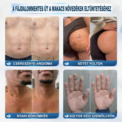 𝐇𝐢𝐯𝐚𝐭𝒂𝒍𝒐𝒔 𝒎á𝗿𝗸𝗮𝗯𝗼𝗹𝐭 | 🖊️ 𝐏i𝐜𝐝𝐨® 𝟕 𝐧𝐚𝒑𝒐𝒔 𝒔𝒛𝗲𝗺ö𝗹𝗰𝘀- é𝐬 𝐟𝐨𝐥𝐭𝐞𝐥í𝐭ó (𝐟á𝐣𝐝𝐚𝐥𝒐𝒎𝒎𝒆𝒏𝒕𝒆𝒔, 𝒉𝒆𝗴 𝗻é𝗹𝗸ü𝐥𝐢 𝐠𝐨𝐥𝐲ó𝐬 𝐚𝐩𝐩𝐥𝐢𝐤á𝐭𝐨𝐫)🎄