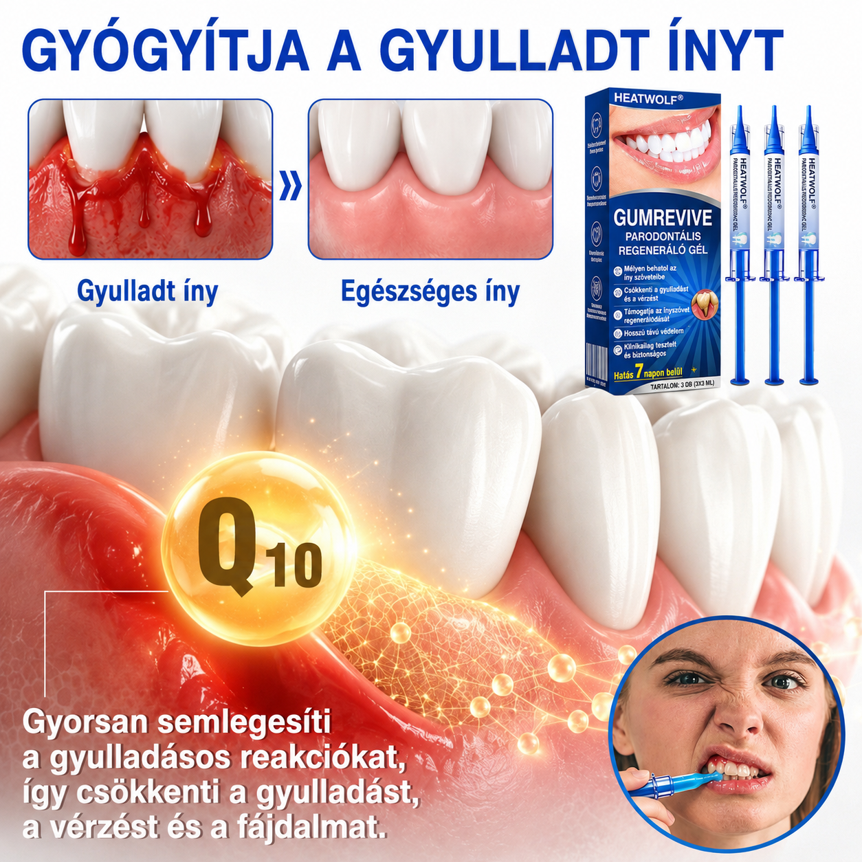 🇭🇺👨‍⚕️✅🦷 HEATWOLF® GumRevive – Parodontális helyreállító gél🍿