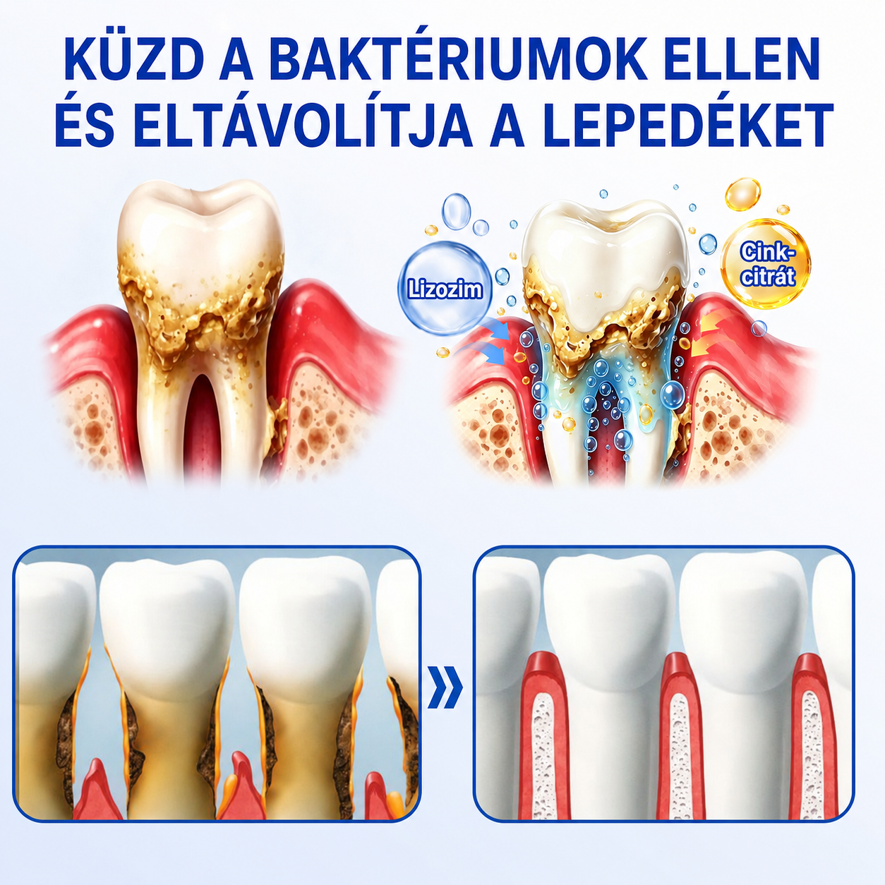 🇭🇺👨‍⚕️✅🦷 HEATWOLF® GumRevive – Parodontális helyreállító gél🍿