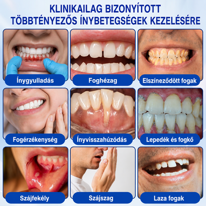 🇭🇺👨‍⚕️✅🦷 HEATWOLF® GumRevive – Parodontális helyreállító gél🍿